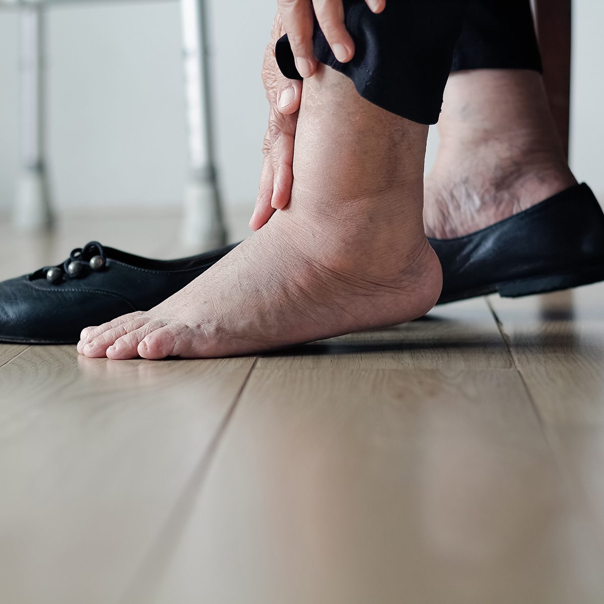 Elderly woman swollen feet putting on shoes