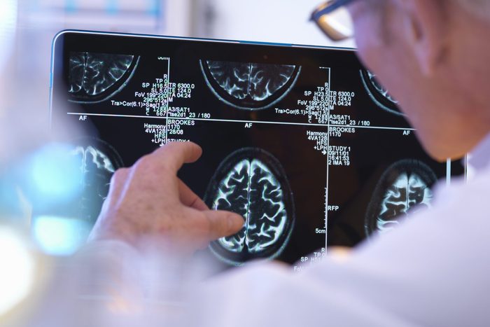 doctor pointing at brain mri images
